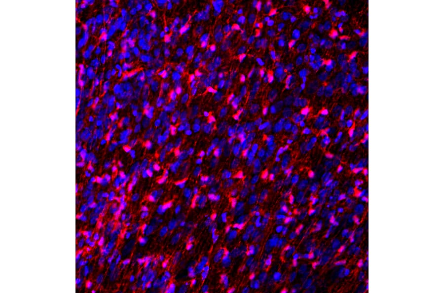 Immunofluorescence - Anti-FABP7 Antibody (A104339) - Antibodies.com