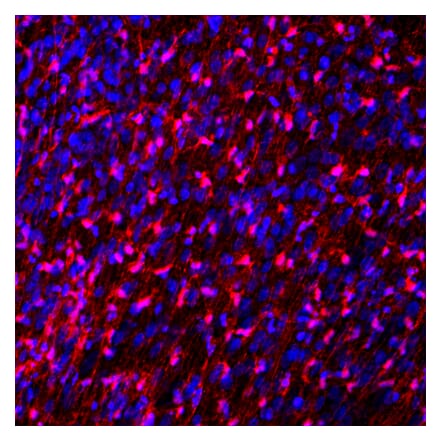 Immunofluorescence - Anti-FABP7 Antibody (A104339) - Antibodies.com