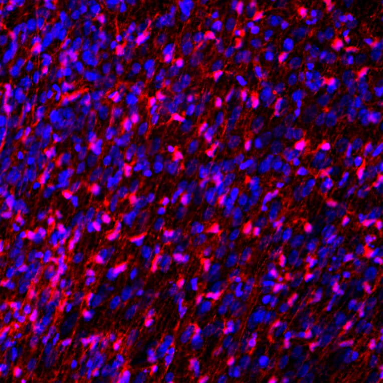 Immunofluorescence - Anti-FABP7 Antibody (A104339) - Antibodies.com