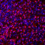 Immunofluorescence - Anti-FABP7 Antibody (A104339) - Antibodies.com