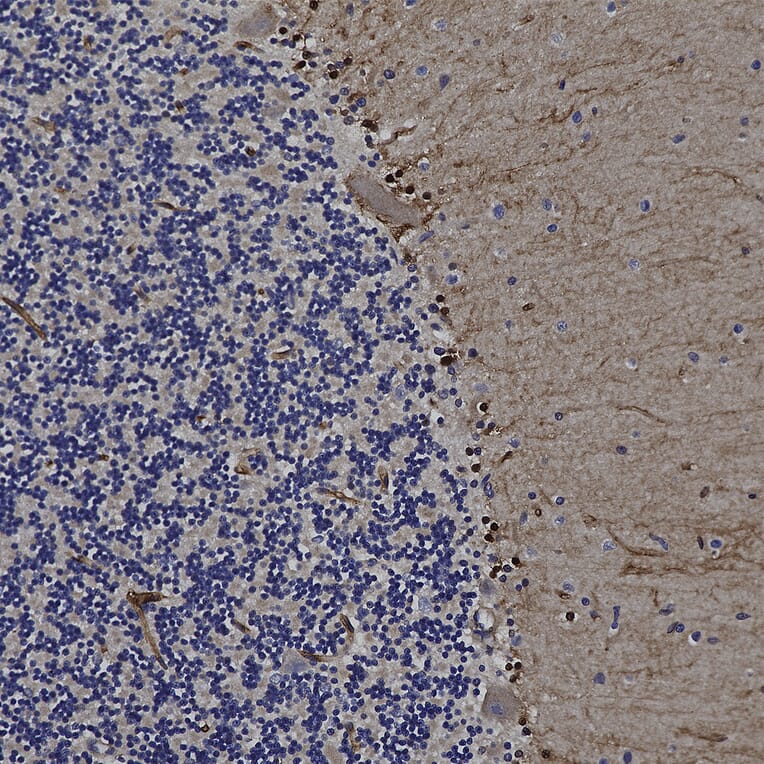 Immunohistochemistry - Anti-FABP7 Antibody (A104339) - Antibodies.com