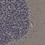 Immunohistochemistry - Anti-FABP7 Antibody (A104339) - Antibodies.com