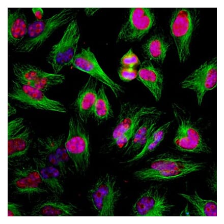 Immunofluorescence - Anti-Ki67 Antibody - Antibodies.com (A104340)