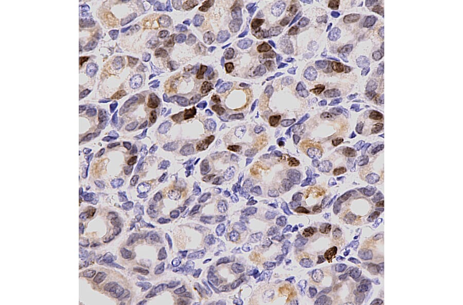 Immunohistochemistry - Anti-Ki67 Antibody (A104340) - Antibodies.com