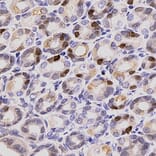 Immunohistochemistry - Anti-Ki67 Antibody (A104340) - Antibodies.com