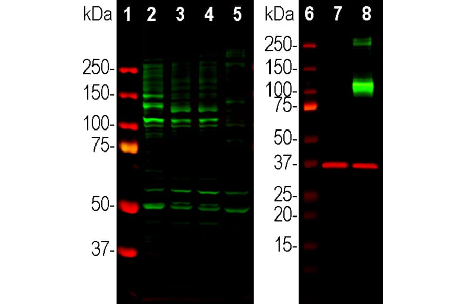 Western Blot - Anti-Adenylate Cyclase 3 Antibody (A104341) - Antibodies.com