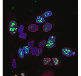 Immunofluorescence - Anti-Ki67 Antibody [6B4] (A104344) - Antibodies.com