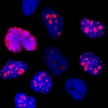 Immunofluorescence - Anti-Ki67 Antibody - Antibodies.com (A104345)