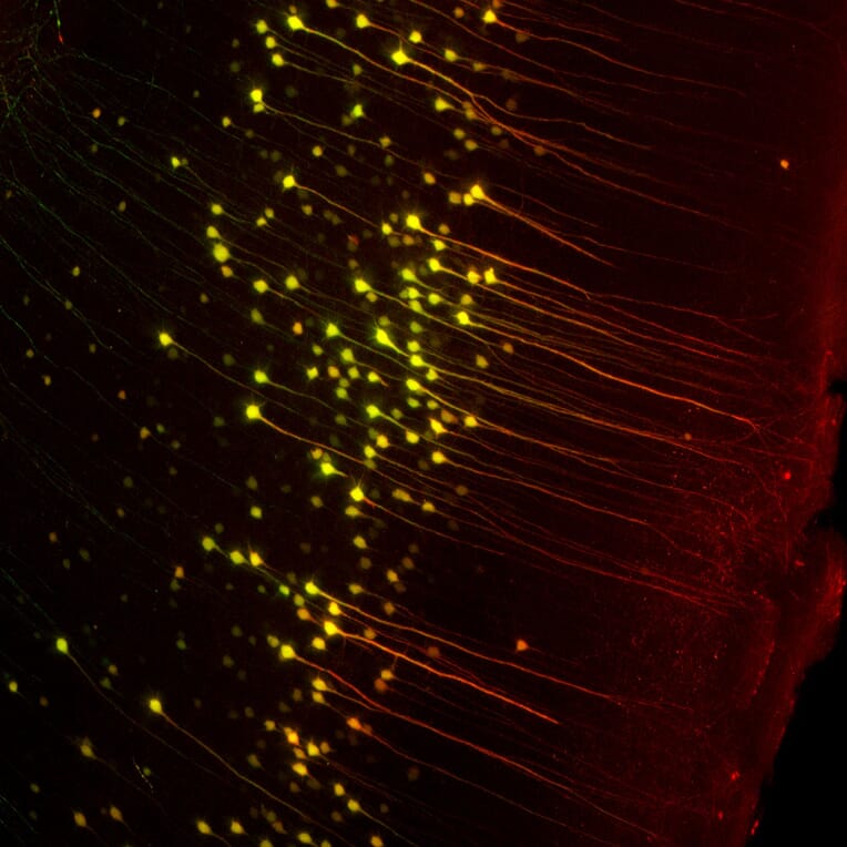 Immunofluorescence - Anti-GFP Antibody (A104347) - Antibodies.com