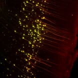 Immunofluorescence - Anti-GFP Antibody (A104347) - Antibodies.com