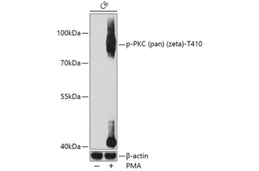 Western Blot - Anti-pan PKC (phospho Thr410) Antibody (A11000) - Antibodies.com