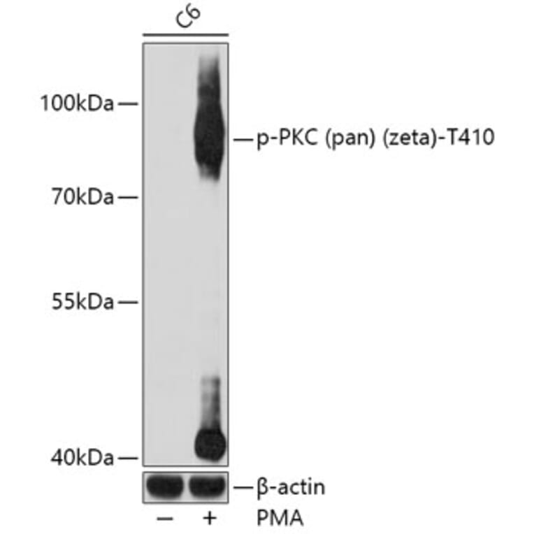 Western Blot - Anti-pan PKC (phospho Thr410) Antibody (A11000) - Antibodies.com