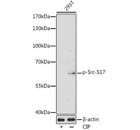 Western Blot - Anti-Src (Phospho S17) Antibody (A11001) - Antibodies.com