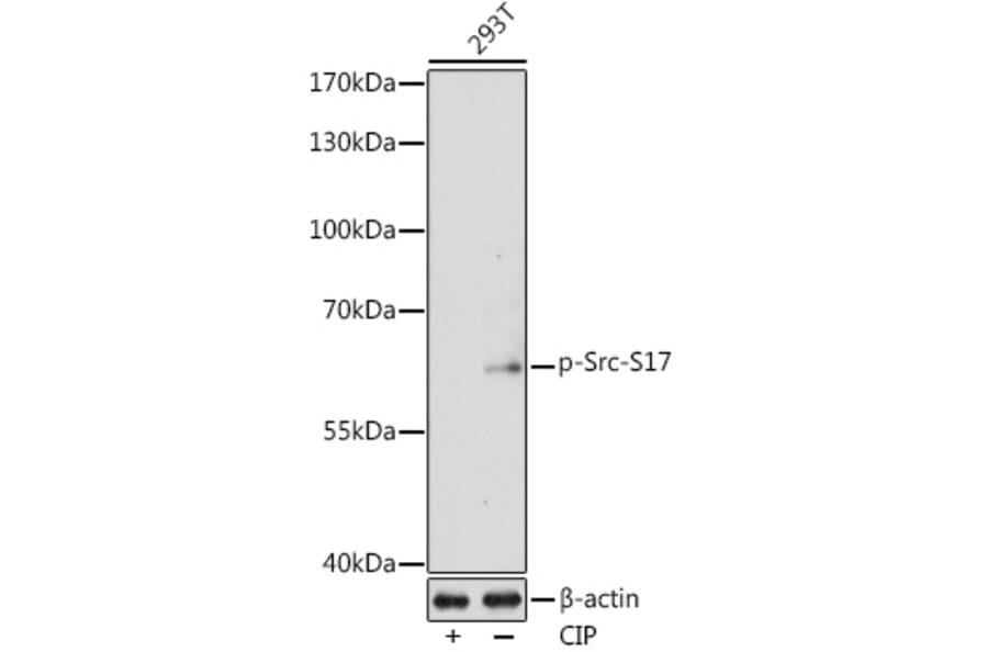 Western Blot - Anti-Src (Phospho S17) Antibody (A11001) - Antibodies.com