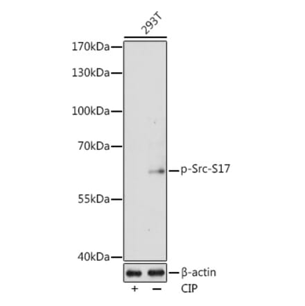 Western Blot - Anti-Src (Phospho S17) Antibody (A11001) - Antibodies.com