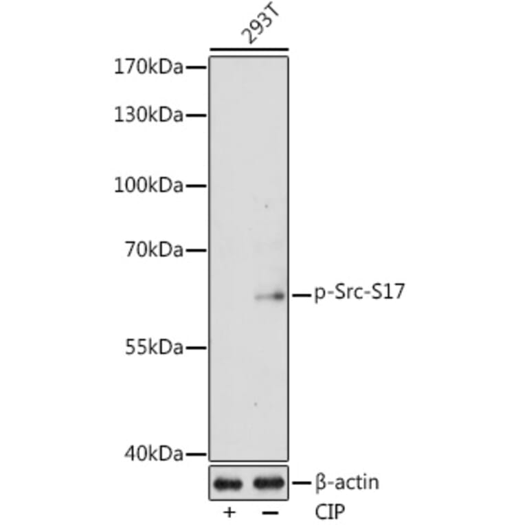 Western Blot - Anti-Src (Phospho S17) Antibody (A11001) - Antibodies.com
