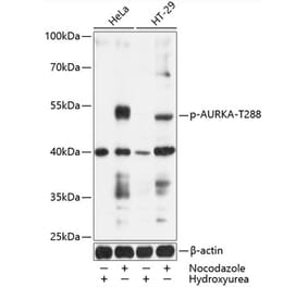 Western Blot - Anti-Aurora A (phospho Thr288) Antibody (A11002) - Antibodies.com