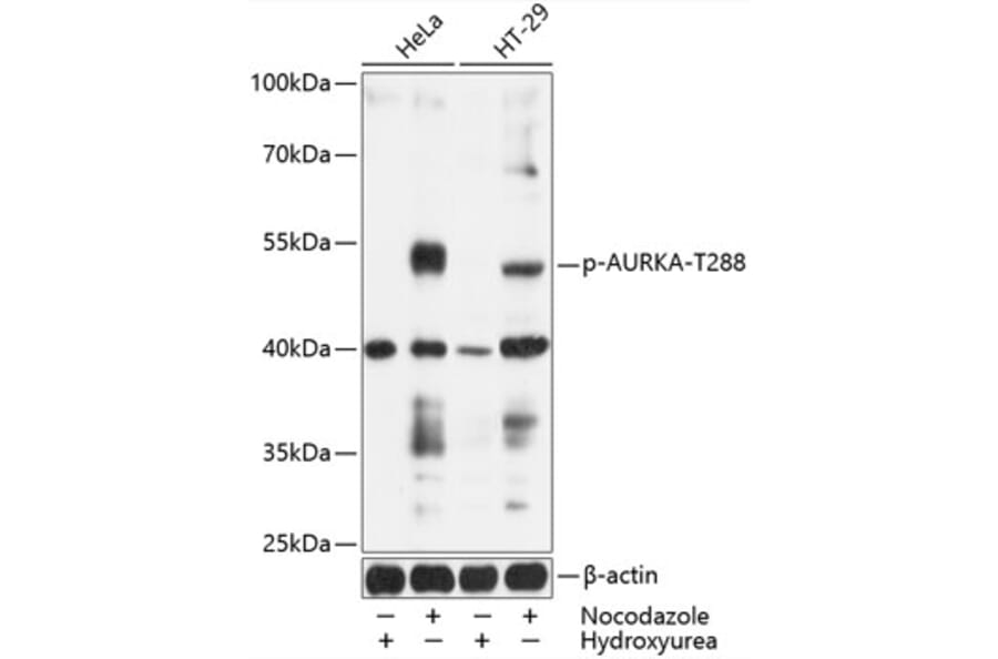 Western Blot - Anti-Aurora A (phospho Thr288) Antibody (A11002) - Antibodies.com