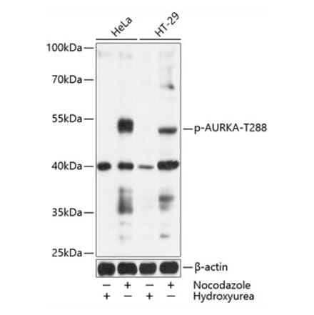 Western Blot - Anti-Aurora A (phospho Thr288) Antibody (A11002) - Antibodies.com