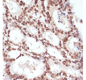 Immunohistochemistry - Anti-beta Catenin (phospho Ser33 + Ser37 + Thr41) Antibody (A11003) - Antibodies.com