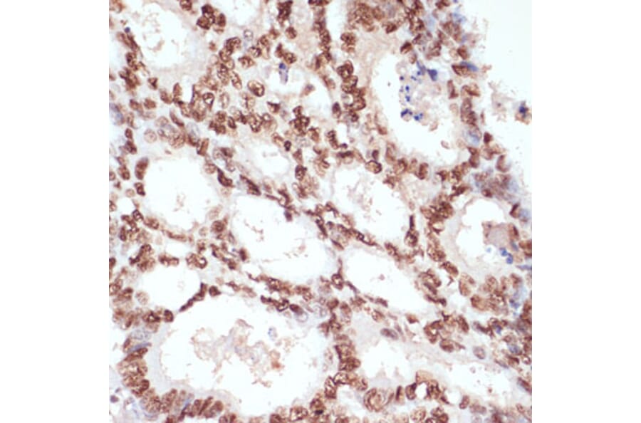 Immunohistochemistry - Anti-beta Catenin (phospho Ser33 + Ser37 + Thr41) Antibody (A11003) - Antibodies.com