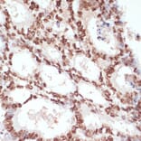 Immunohistochemistry - Anti-beta Catenin (phospho Ser33 + Ser37 + Thr41) Antibody (A11003) - Antibodies.com