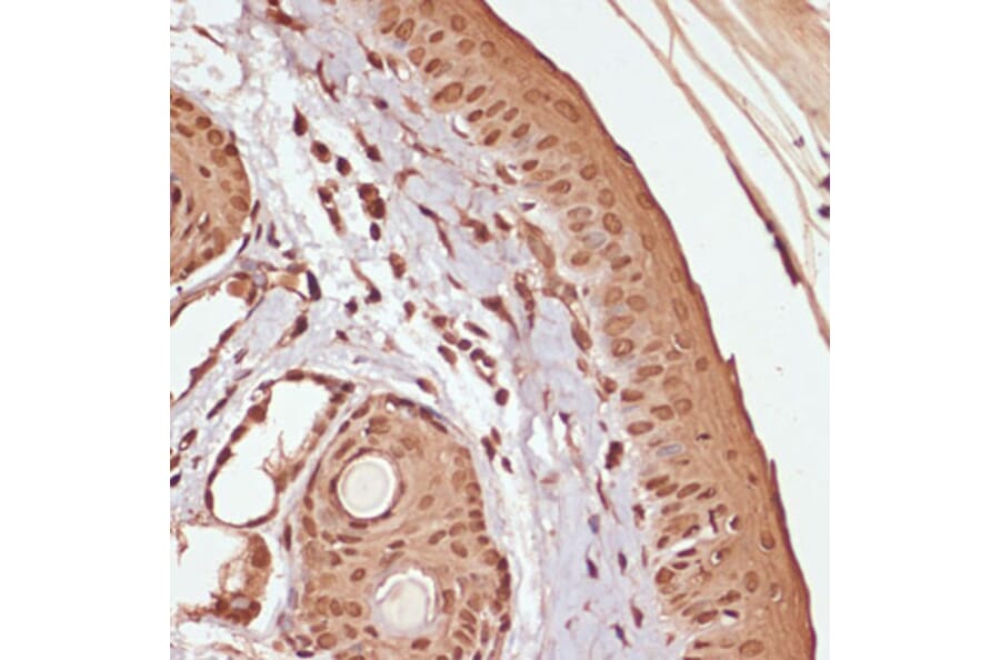 Immunohistochemistry - Anti-beta Catenin (phospho Ser33 + Ser37 + Thr41) Antibody (A11003) - Antibodies.com