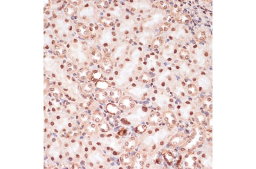 Immunohistochemistry - Anti-beta Catenin (phospho Ser33 + Ser37 + Thr41) Antibody (A11003) - Antibodies.com