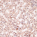 Immunohistochemistry - Anti-beta Catenin (phospho Ser33 + Ser37 + Thr41) Antibody (A11003) - Antibodies.com
