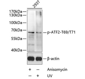 Western Blot - Anti-ATF2 (phospho Thr69 + Thr71) Antibody (A11004) - Antibodies.com