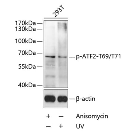 Western Blot - Anti-ATF2 (phospho Thr69 + Thr71) Antibody (A11004) - Antibodies.com