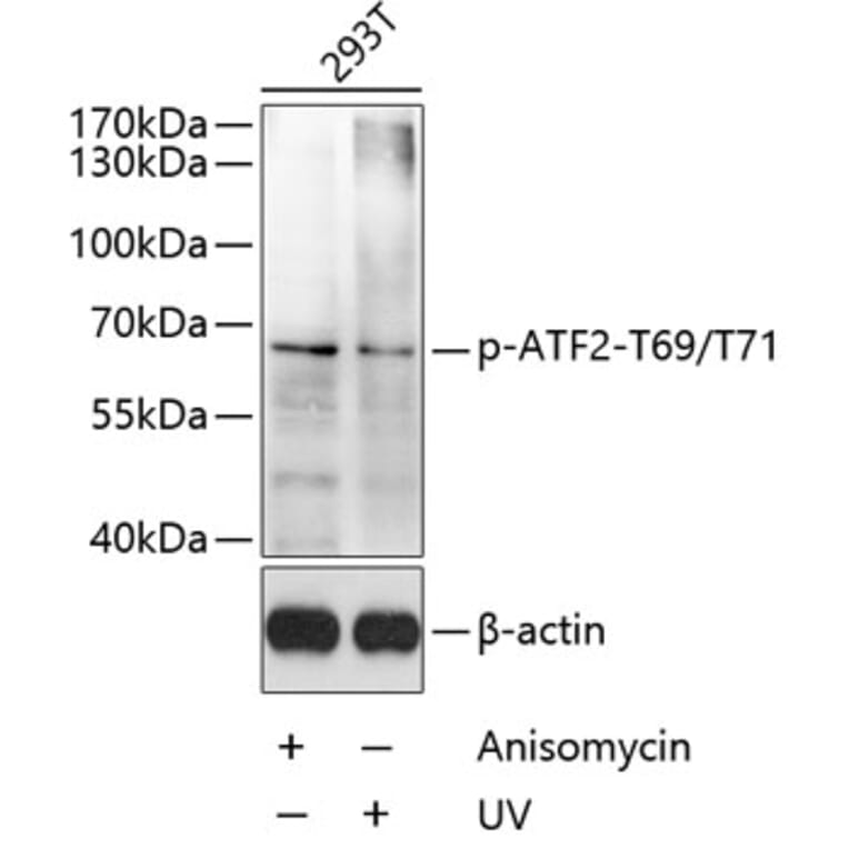 Western Blot - Anti-ATF2 (phospho Thr69 + Thr71) Antibody (A11004) - Antibodies.com