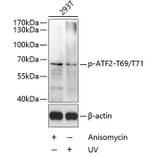 Western Blot - Anti-ATF2 (phospho Thr69 + Thr71) Antibody (A11004) - Antibodies.com