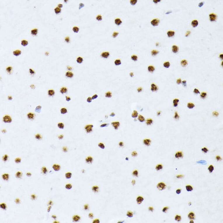 Immunohistochemistry - Anti-ATF2 (phospho Thr69 + Thr71) Antibody (A11004) - Antibodies.com