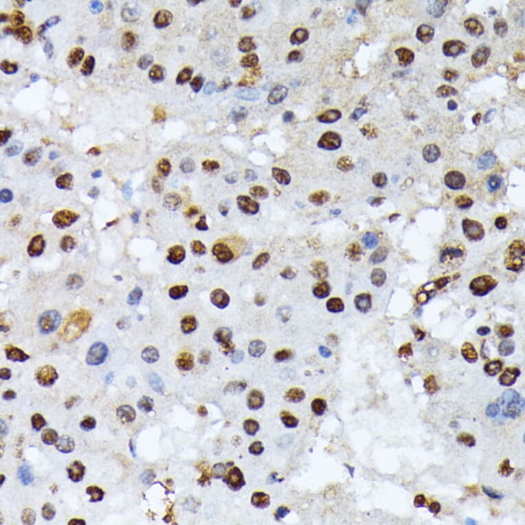 Immunohistochemistry - Anti-ATF2 (phospho Thr69 + Thr71) Antibody (A11004) - Antibodies.com