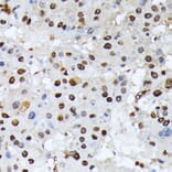 Immunohistochemistry - Anti-ATF2 (phospho Thr69 + Thr71) Antibody (A11004) - Antibodies.com