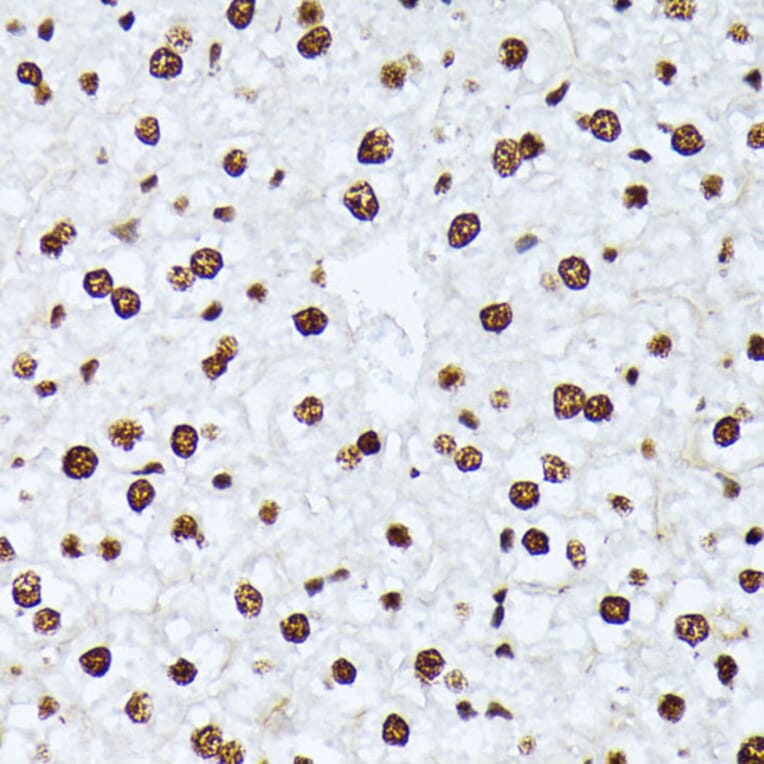 Immunohistochemistry - Anti-ATF2 (phospho Thr69 + Thr71) Antibody (A11004) - Antibodies.com