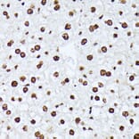 Immunohistochemistry - Anti-ATF2 (phospho Thr69 + Thr71) Antibody (A11004) - Antibodies.com