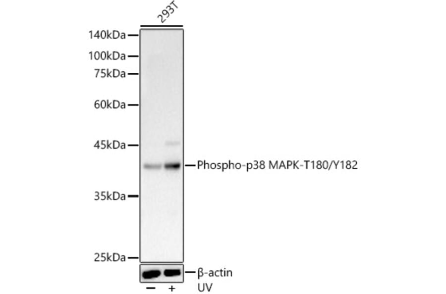 Western Blot - Anti-p38 MAPK (phospho Thr180 + Tyr182) Antibody (A11005) - Antibodies.com