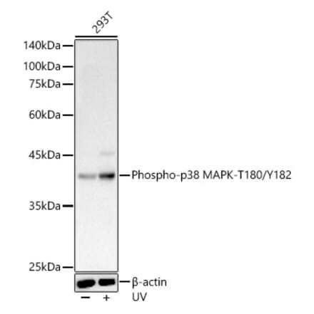 Western Blot - Anti-p38 MAPK (phospho Thr180 + Tyr182) Antibody (A11005) - Antibodies.com