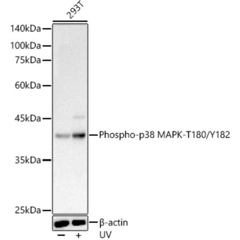 Western Blot - Anti-p38 MAPK (phospho Thr180 + Tyr182) Antibody (A11005) - Antibodies.com