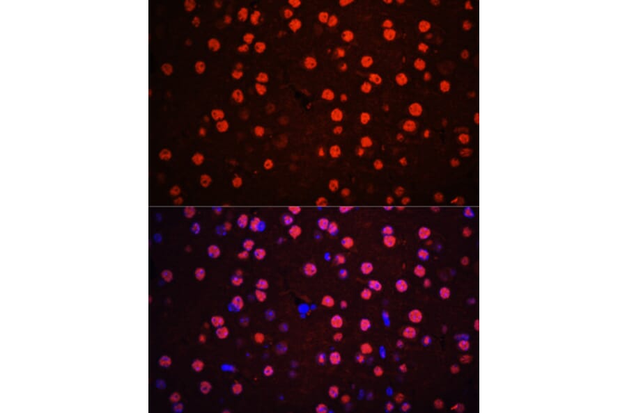 Immunofluorescence - Anti-p38 MAPK (phospho Thr180 + Tyr182) Antibody (A11005) - Antibodies.com