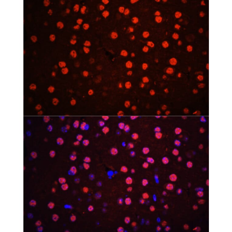 Immunofluorescence - Anti-p38 MAPK (phospho Thr180 + Tyr182) Antibody (A11005) - Antibodies.com