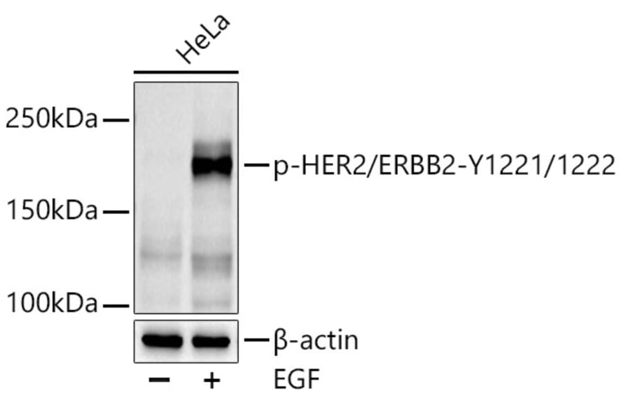 Western Blot - Anti-ErbB2/HER2 (phospho Tyr1221 + 1222) Antibody (A11006) - Antibodies.com