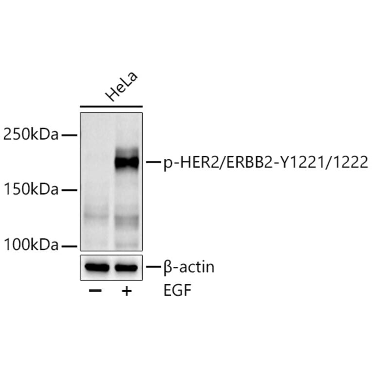 Western Blot - Anti-ErbB2/HER2 (phospho Tyr1221 + 1222) Antibody (A11006) - Antibodies.com