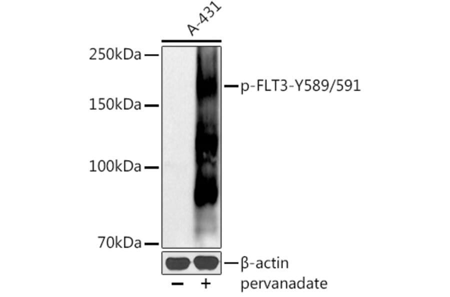 Western Blot - Anti-Flt3/CD135 (phospho Tyr589 + Tyr591) Antibody (A11008) - Antibodies.com