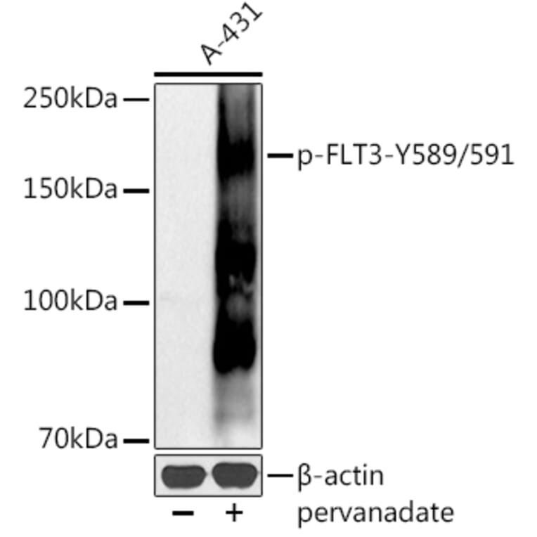 Western Blot - Anti-Flt3/CD135 (phospho Tyr589 + Tyr591) Antibody (A11008) - Antibodies.com