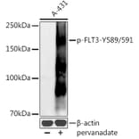 Western Blot - Anti-Flt3/CD135 (phospho Tyr589 + Tyr591) Antibody (A11008) - Antibodies.com