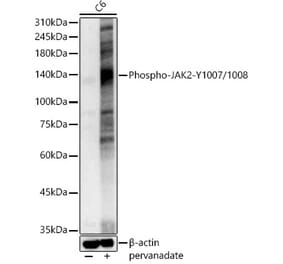 Western Blot - Anti-JAK2 (phospho Tyr1007 + Tyr1008) Antibody (A11009) - Antibodies.com