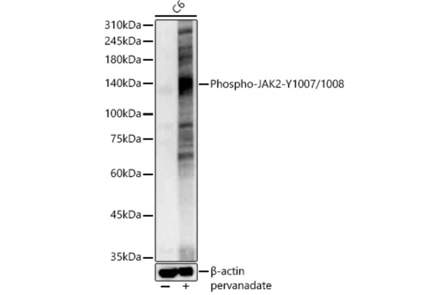 Western Blot - Anti-JAK2 (phospho Tyr1007 + Tyr1008) Antibody (A11009) - Antibodies.com